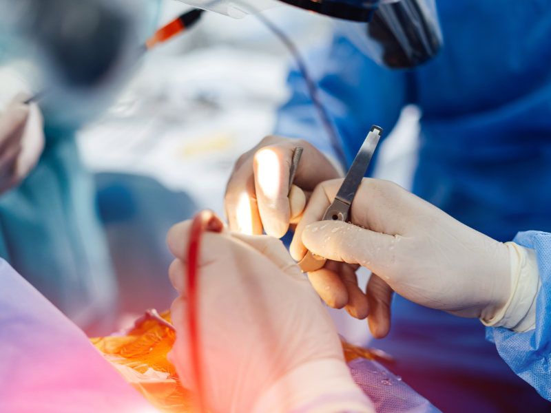 Craniotomy Surgery Cost In India, Impact Guru