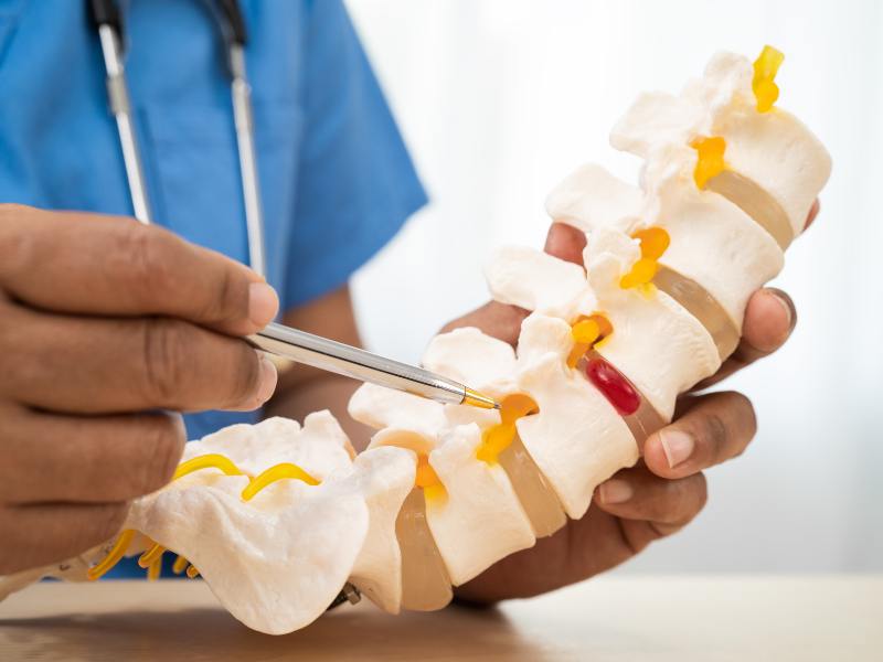 Kyphoplasty Cost