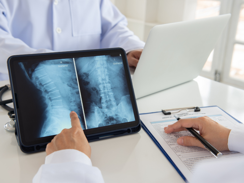 Kyphoplasty Surgery Cost