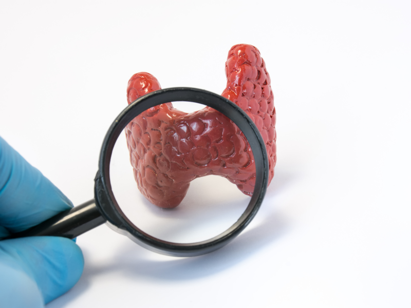 Thyroid Stimulating Hormone