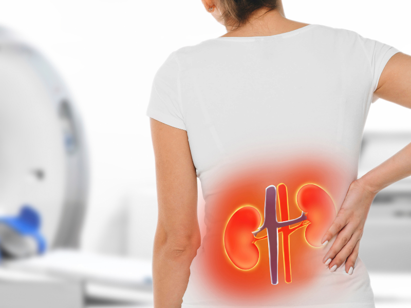 Kidney Stone Scanning Cost