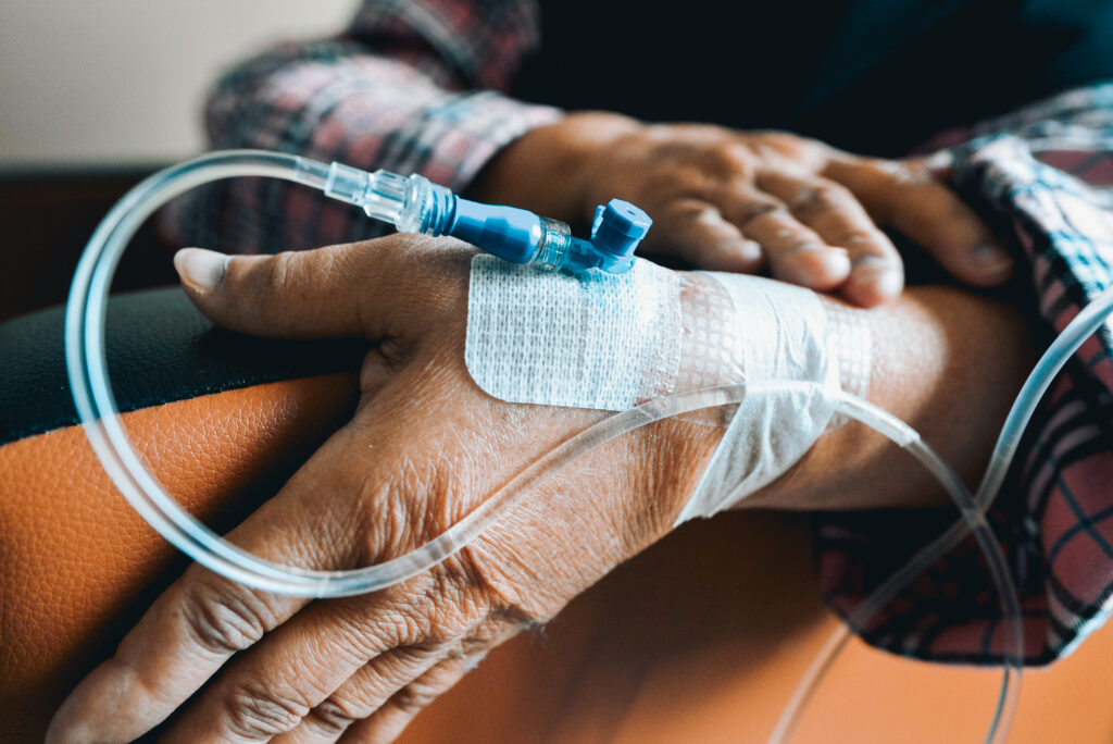 Radiotherapy vs Chemotherapy