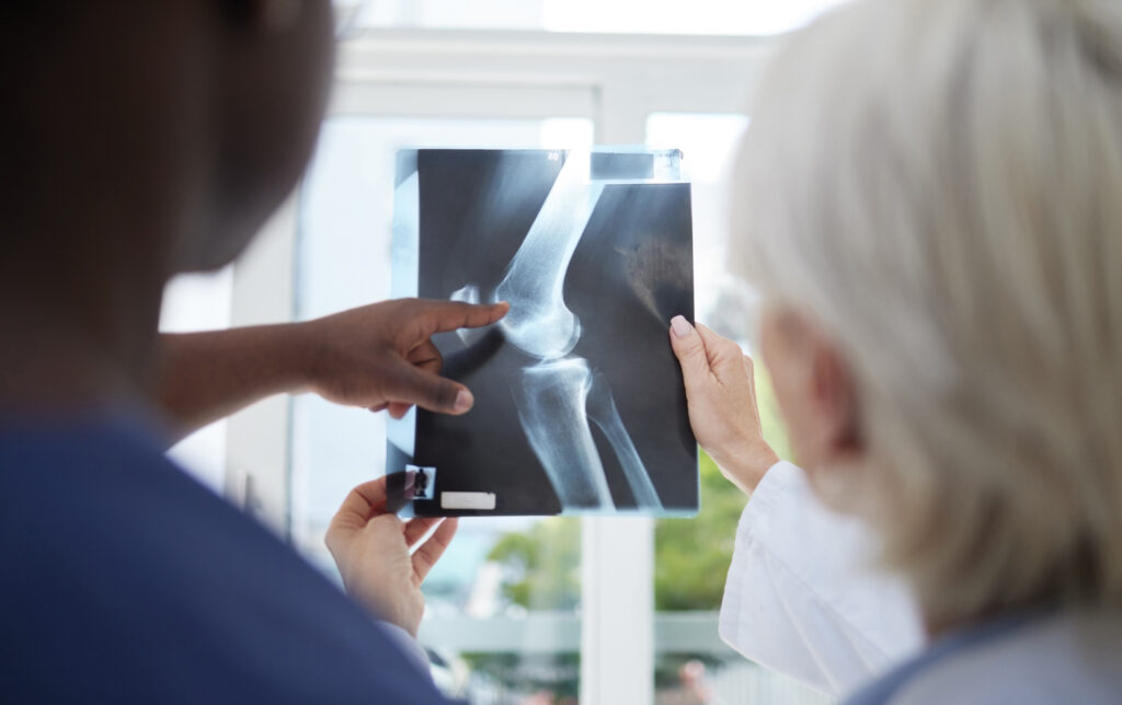 Top 10 Orthopedic Hospital in Bangalore