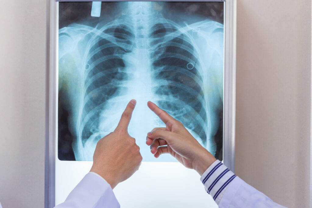 Top Orthopedic Hospital in Bangalore
