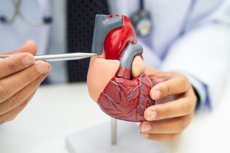 Heart Transplant in Hyderabad