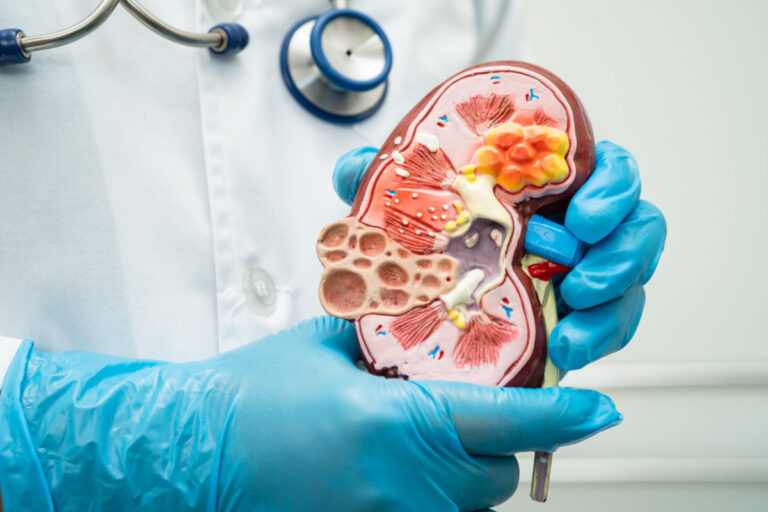 Kidney Transplant in Pune