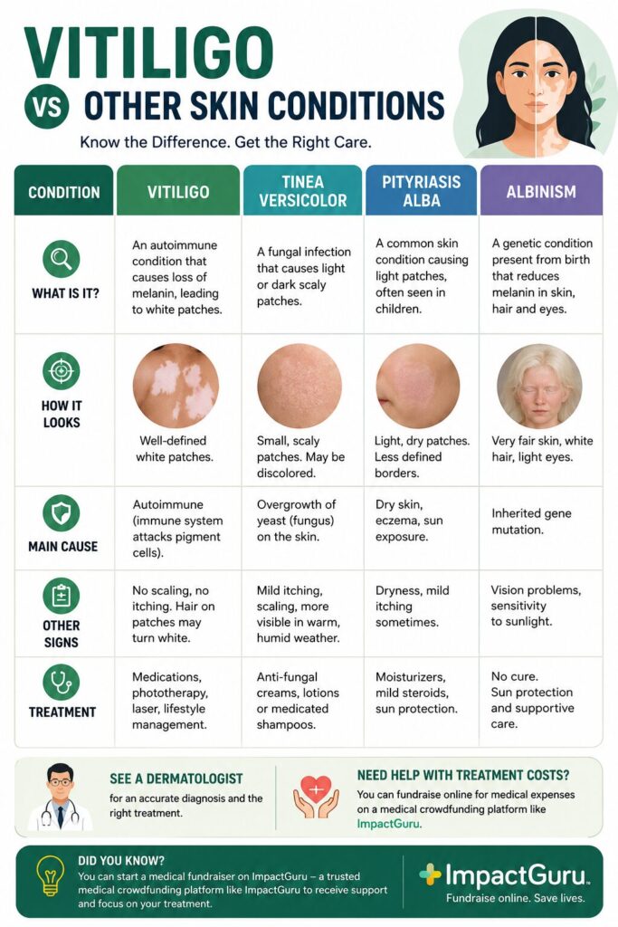 Vitiligo vs Other Skin Conditions