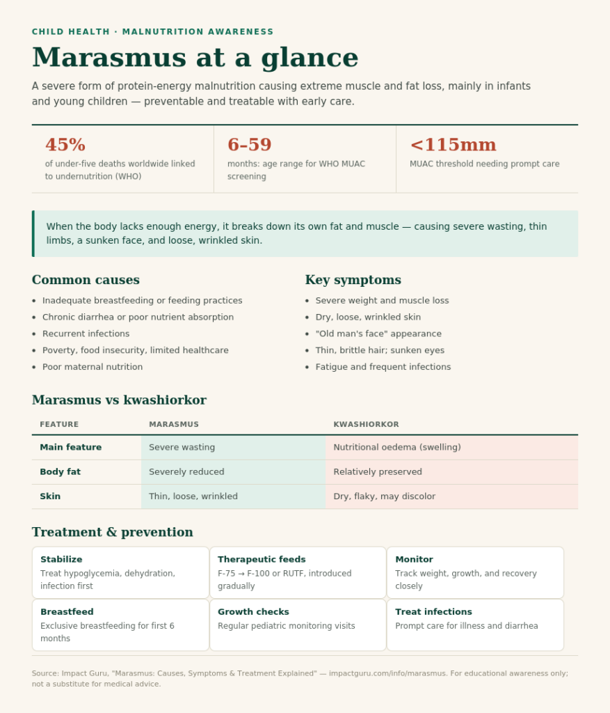 Marasmus: Causes, Symptoms & Treatment Explained